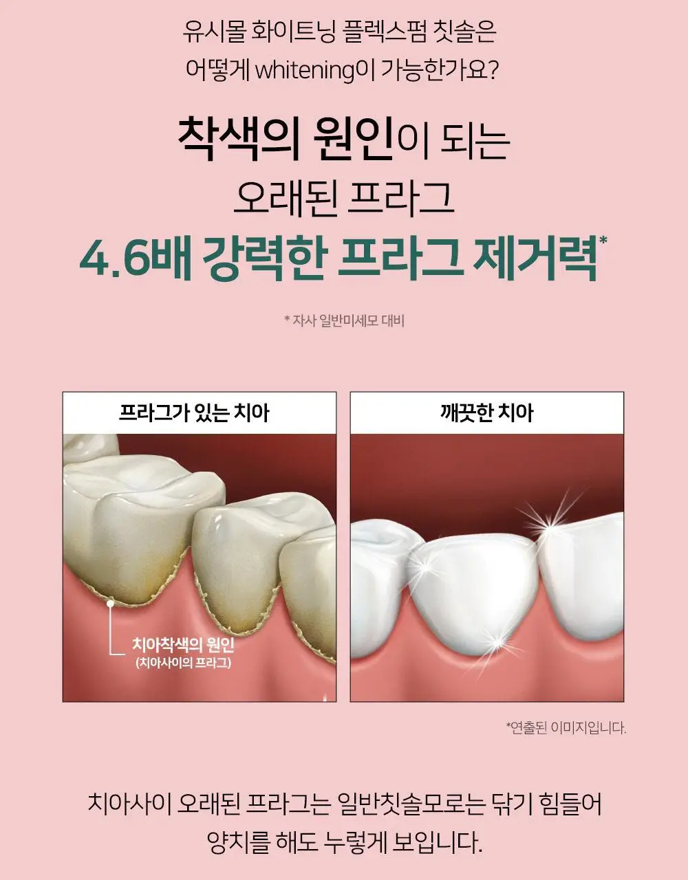 [색상랜덤] 유시몰 화이트닝 칫솔 1입 (핑크/화이트) 상세페이지 8